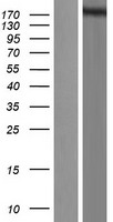 hSET1 (SETD1A) Human Over-expression Lysates NM_014712