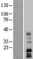 LAPTM4A Human Over-expression Lysates NM_014713