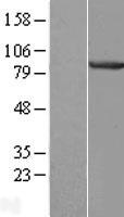 CENTB1 (ACAP1) Human Over-expression Lysates NM_014716