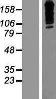 ZNF536 Human Over-expression Lysates NM_014717
