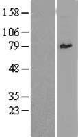 ZNF96 (ZSCAN12) Human Over-expression Lysates NM_001039643