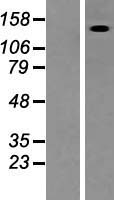 FRMPD4 Human Over-expression Lysates NM_014728