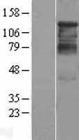 HDAC4 Human Over-expression Lysates NM_006037