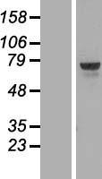 TOX1 (TOX) Human Over-expression Lysates NM_014729