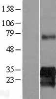 KIAA0247 (SUSD6) Human Over-expression Lysates NM_014734