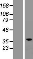 RASSF2 Human Over-expression Lysates NM_170774