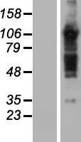TBC1D5 Human Over-expression Lysates NM_014744