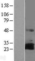 RNF144 (RNF144A) Human Over-expression Lysates NM_014746