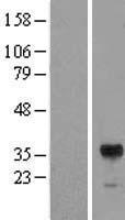 RIMS3 Human Over-expression Lysates NM_014747