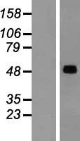 SNX17 Human Over-expression Lysates NM_014748