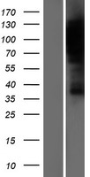 HURP (DLGAP5) Human Over-expression Lysates NM_014750