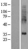 PTDSS1 Human Over-expression Lysates NM_014754