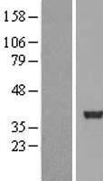 ls009792 sertad2 human over expression lysates nm 014755 wb testing 1
