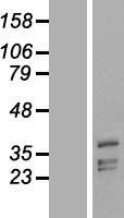 PHYHIP Human Over-expression Lysates NM_001099335