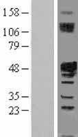 IST1 Human Over-expression Lysates NM_014761