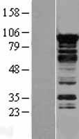 MRPL19 Human Over-expression Lysates NM_014763