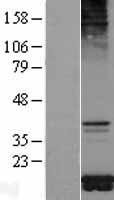 TOMM20 Human Over-expression Lysates NM_014765