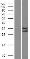 ls009807 ip6k1 human over expression lysates nm 001006115 wb testing 1