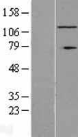 RNF40 Human Over-expression Lysates NM_014771