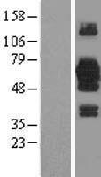KIAA0494 (EFCAB14) Human Over-expression Lysates NM_014774