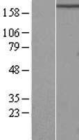 FIP200 (RB1CC1) Human Over-expression Lysates NM_014781