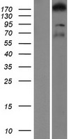 ARHGEF11 Human Over-expression Lysates NM_198236