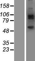 JAKMIP2 Human Over-expression Lysates NM_014790