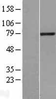 LCMT2 Human Over-expression Lysates NM_014793
