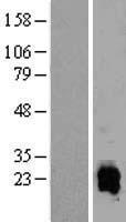 ELMO1 Human Over-expression Lysates NM_001039459
