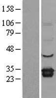 ELMO1 Human Over-expression Lysates NM_130442