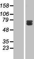 GAB2 Human Over-expression Lysates NM_012296
