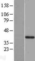 GAB2 Human Over-expression Lysates NM_080491