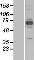 EPM2AIP1 Human Over-expression Lysates NM_014805