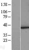 PSMD6 Human Over-expression Lysates NM_014814