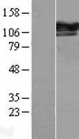 SEC24D Human Over-expression Lysates NM_014822