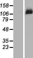 DDX46 Human Over-expression Lysates NM_014829
