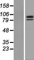 ZBTB39 Human Over-expression Lysates NM_014830