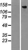 ls009882 tbc1d4 human over expression lysates nm 014832 wb testing 1