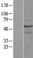 OSBPL2 Human Over-expression Lysates NM_144498