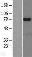 ARK5 (NUAK1) Human Over-expression Lysates NM_014840