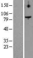 TELO2 Human Over-expression Lysates NM_016111