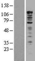 UBAP2L Human Over-expression Lysates NM_014847