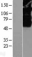 SV2B Human Over-expression Lysates NM_014848
