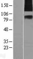 SV2A Human Over-expression Lysates NM_014849