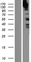 SRGAP3 Human Over-expression Lysates NM_014850