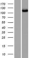 SGSM2 Human Over-expression Lysates NM_001098509