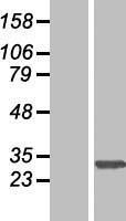 SLC35E2A Human Over-expression Lysates NM_182838