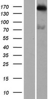 DENND4B Human Over-expression Lysates NM_014856
