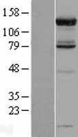 ls009924 pan2 human over expression lysates nm 014871 wb testing 2