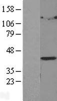 LPGAT1 Human Over-expression Lysates NM_014873